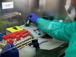 SIMA per la donazione di plasma iperimmune